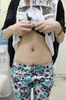 NAVEL