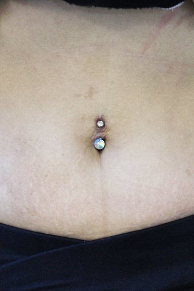 NAVEL(ヘソピアス)